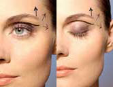 BOTOX® Cosmetic Therapy